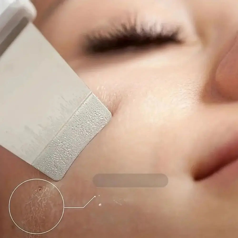 Ultrasonic Skin Deep Pore Cleaning